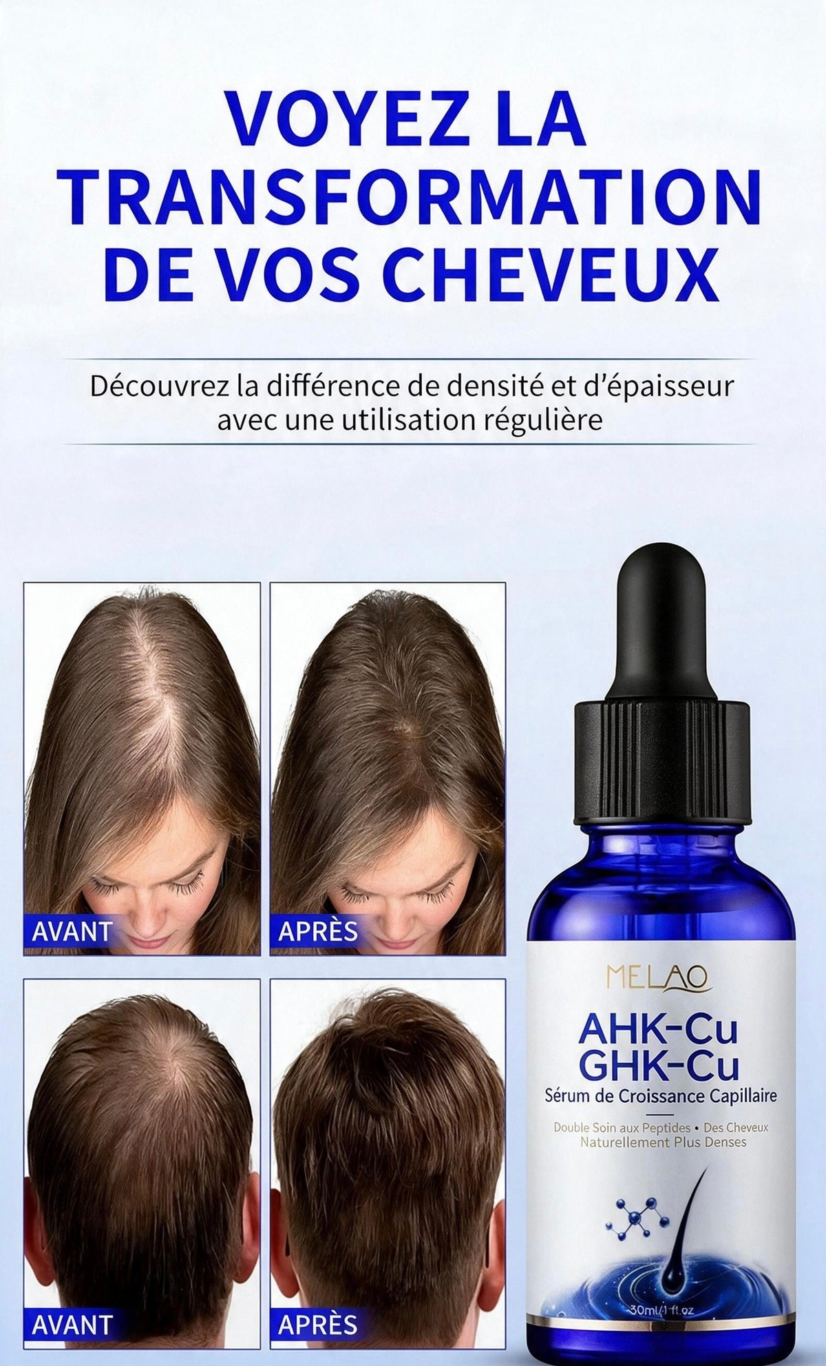 Sérum Capillaire Premium AHK-Cu & GHK-Cu – 30 ml